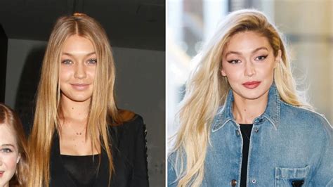 gigi hadid plastic surgery|21 Celebs Who Addressed Plastic Surgery。